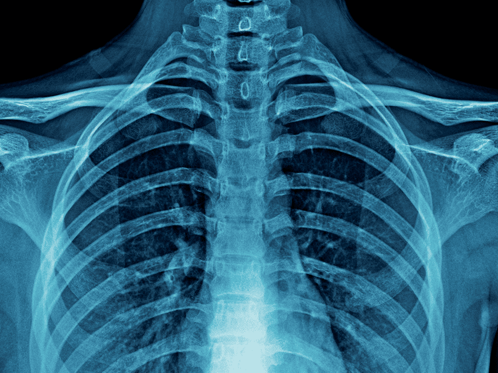 xrays in murrieta