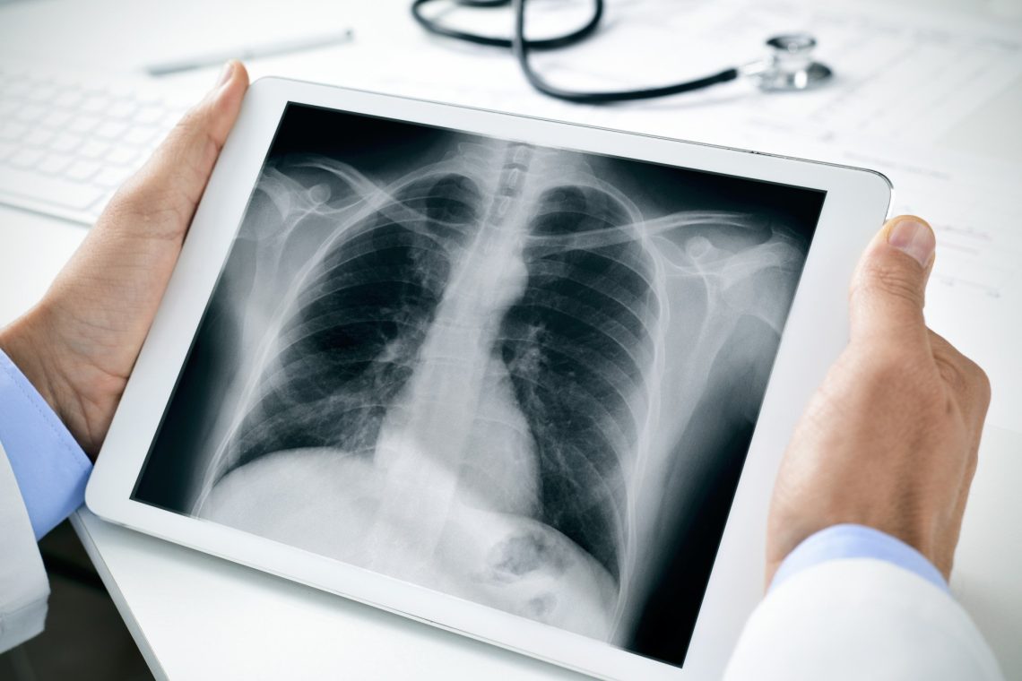xrays in murrieta