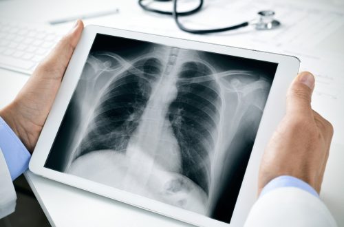 xrays in murrieta